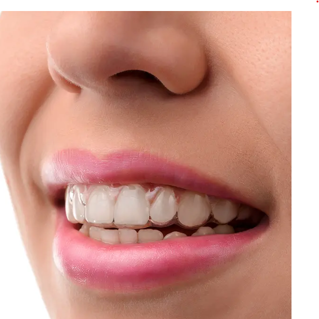 close up of woman wearing Invisalign