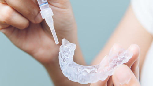 Hands applying whitening gel from a syringe into a custom dental whitening tray
