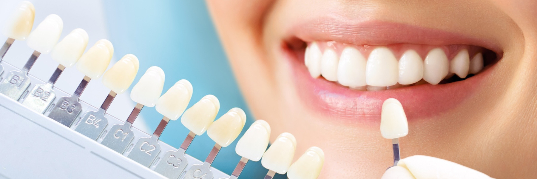 Dentist comparing tooth shade guide to woman's bright white smile for teeth whitening consultation